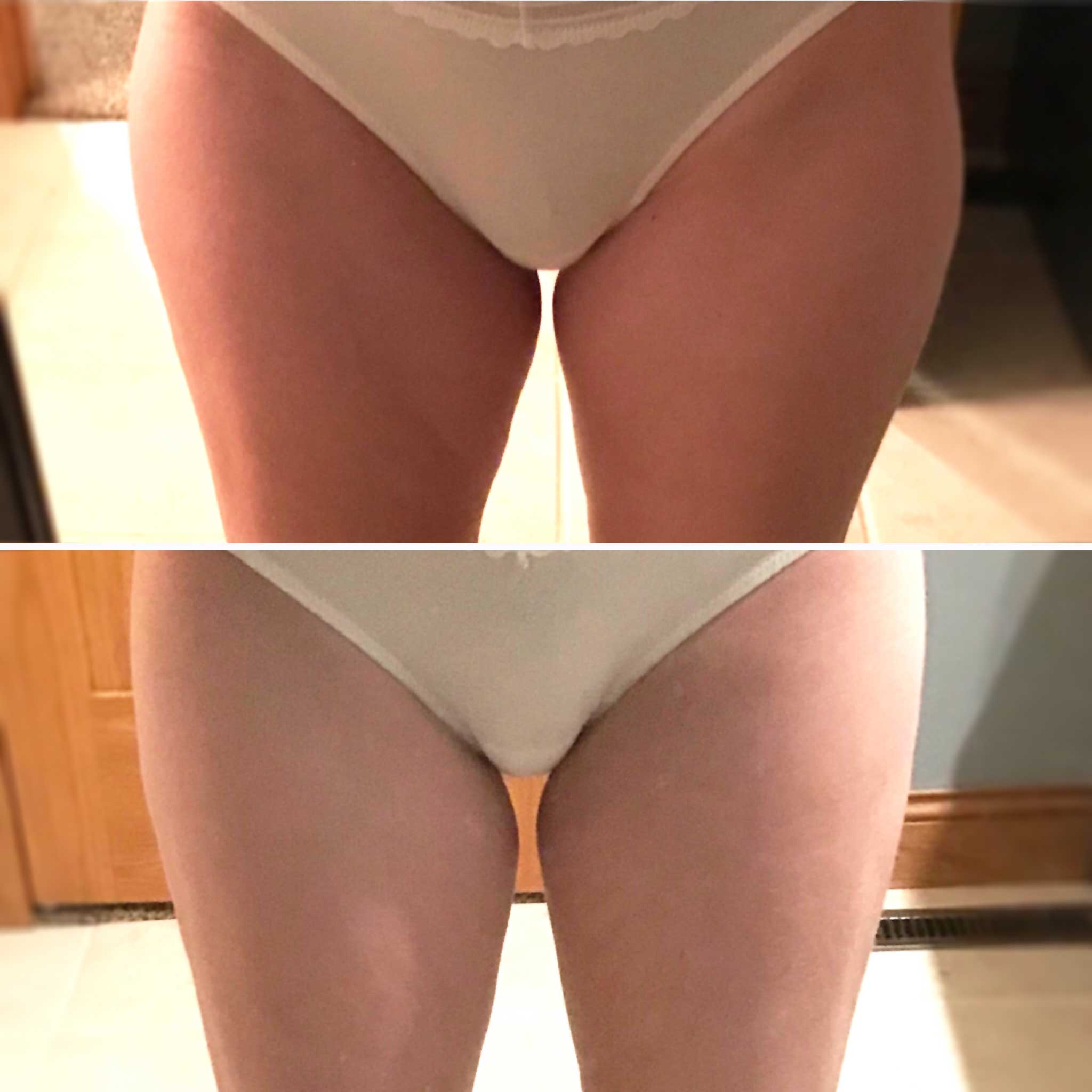 vanquish results on thighs