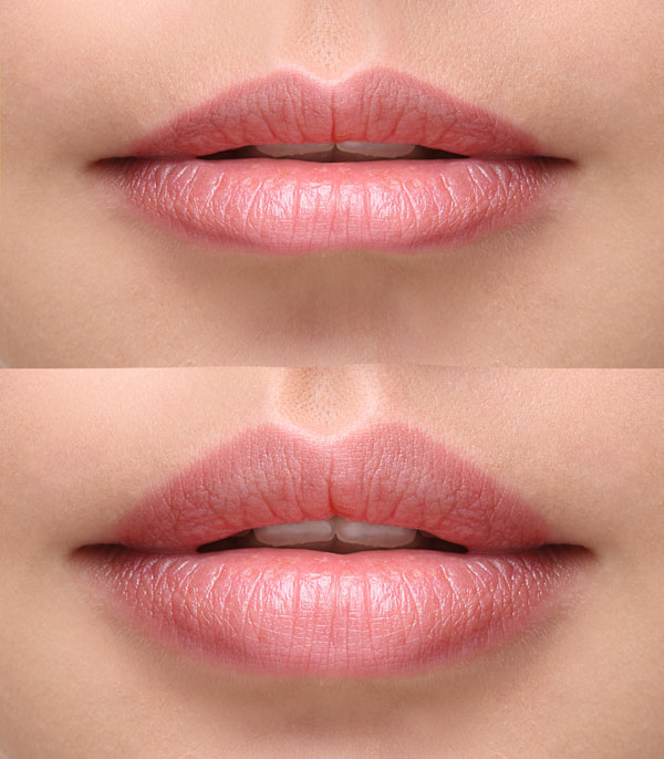 get fuller lips with our products
